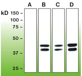 Western Blot - Anti-Erk1 (phospho T202 + Y204) + Erk2 (phospho T185 + Y187) Antibody - Antibodies.com (A8261)