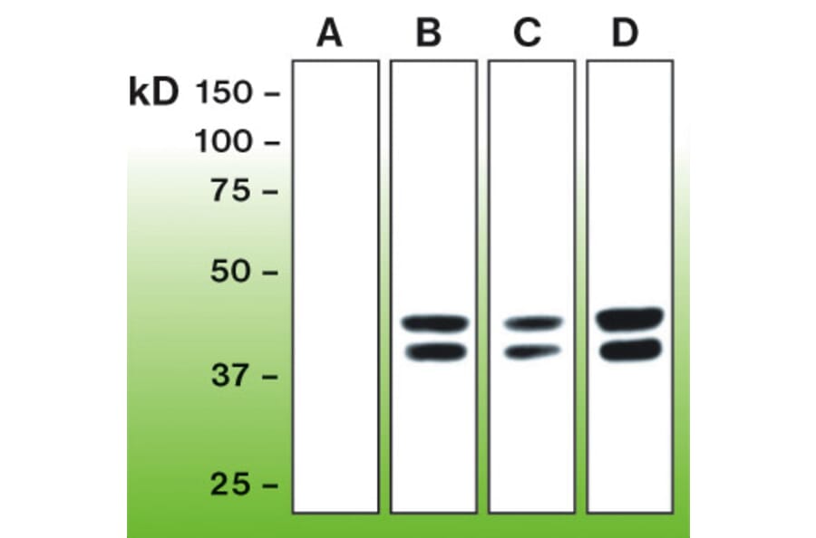 Western Blot - Anti-Erk1 (phospho T202 + Y204) + Erk2 (phospho T185 + Y187) Antibody - Antibodies.com (A8261)