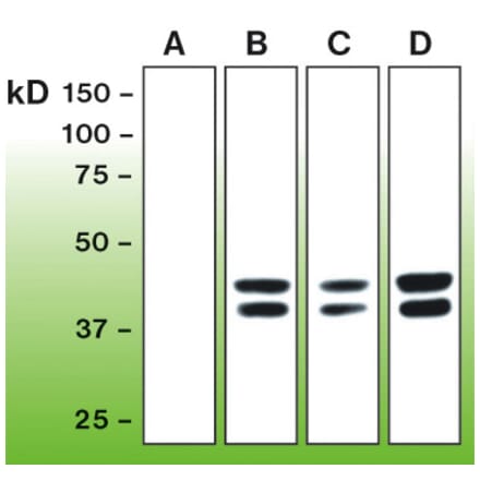 Western Blot - Anti-Erk1 (phospho T202 + Y204) + Erk2 (phospho T185 + Y187) Antibody - Antibodies.com (A8261)