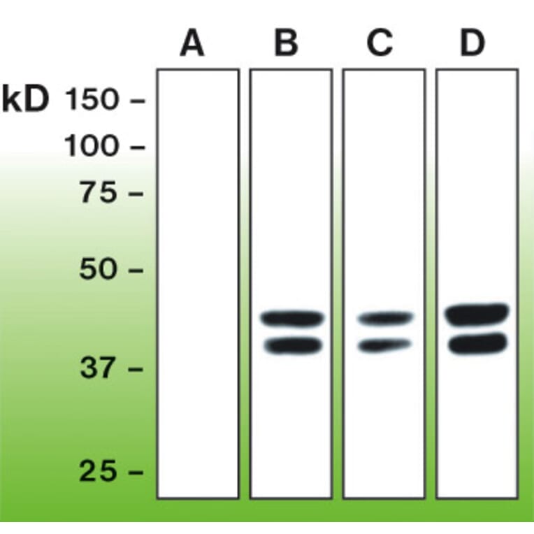 Western Blot - Anti-Erk1 (phospho T202 + Y204) + Erk2 (phospho T185 + Y187) Antibody - Antibodies.com (A8261)