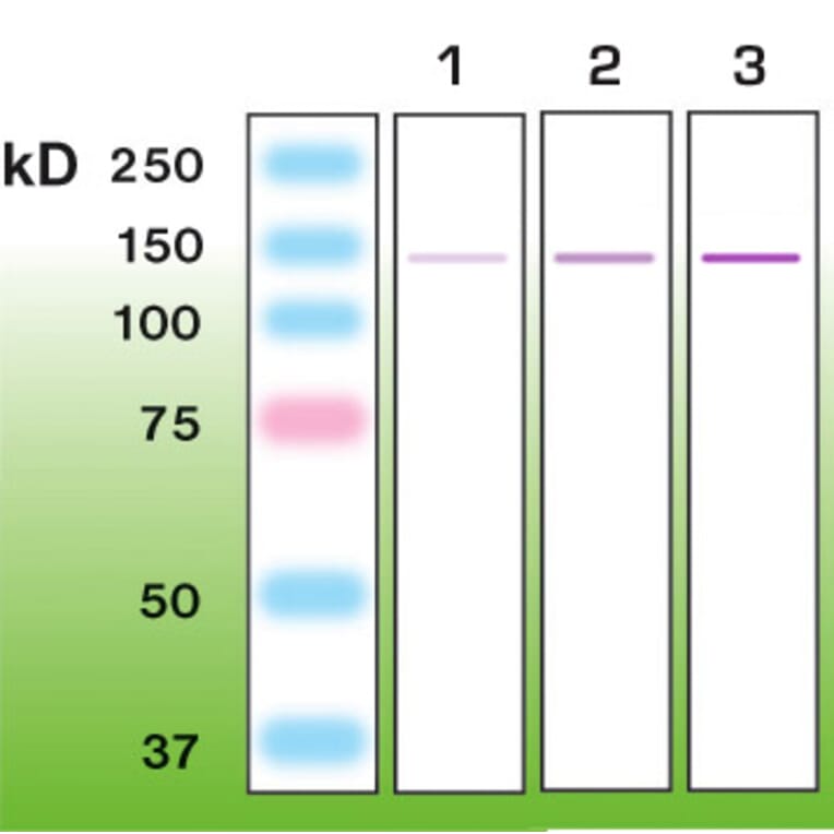 Western Blot - Anti-Nephrin Antibody - Antibodies.com (A8263)