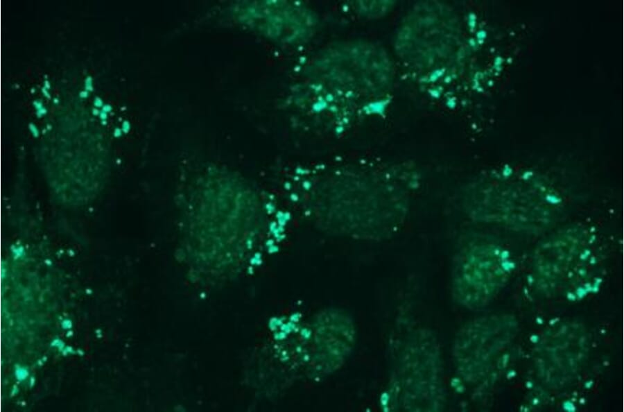Immunocytochemistry - Anti-Nephrin Antibody - Antibodies.com (A8263)