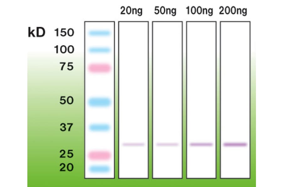 Western Blot - Anti-CTRP5 Antibody - Antibodies.com (A8264)