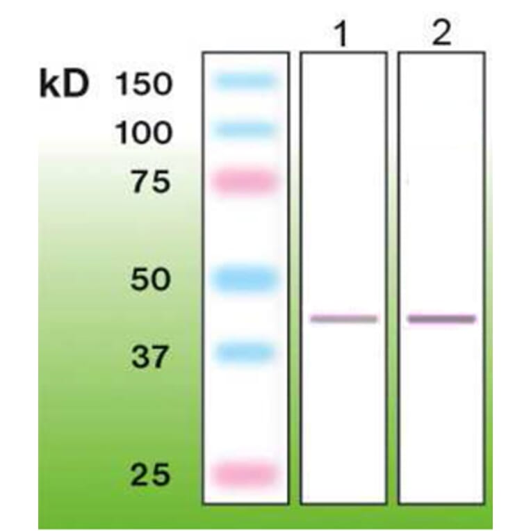Western Blot - Anti-TTF-1 Antibody - Antibodies.com (A8274)