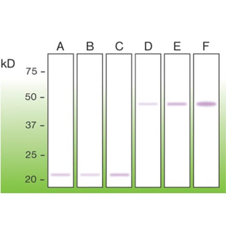 Western Blot - Anti-BAX Antibody - Antibodies.com (A8275)