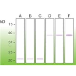 Western Blot - Anti-BAX Antibody - Antibodies.com (A8275)
