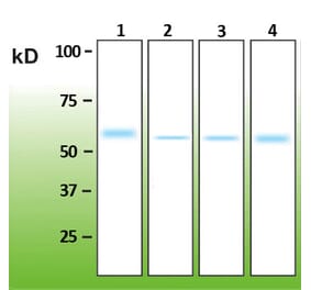 Western Blot - Anti-Akt1 Antibody - Antibodies.com (A8276)