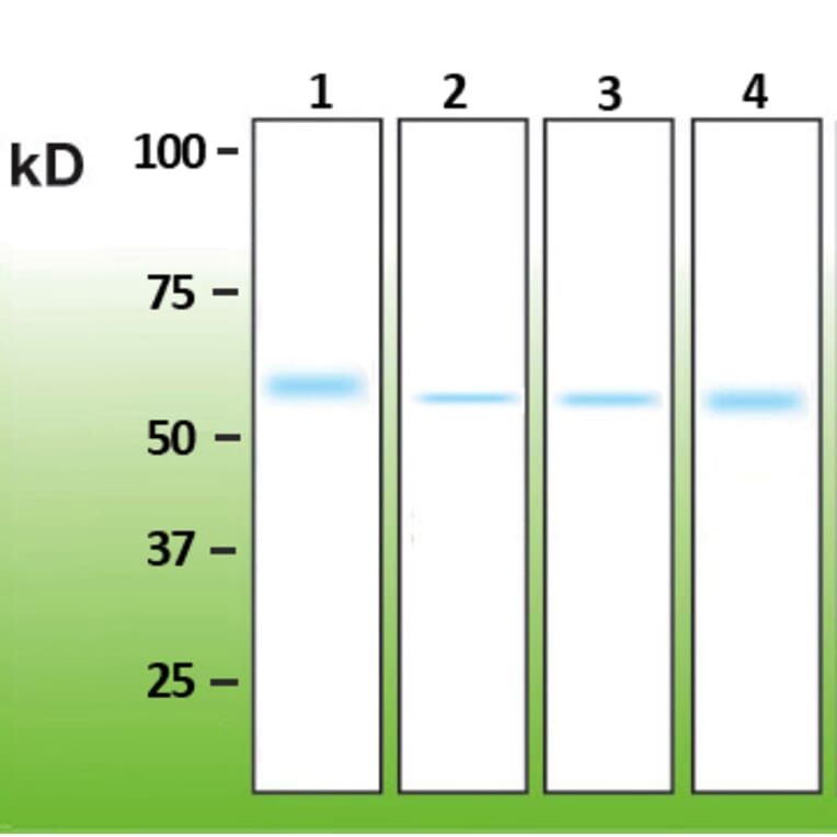 Western Blot - Anti-Akt1 Antibody - Antibodies.com (A8276)