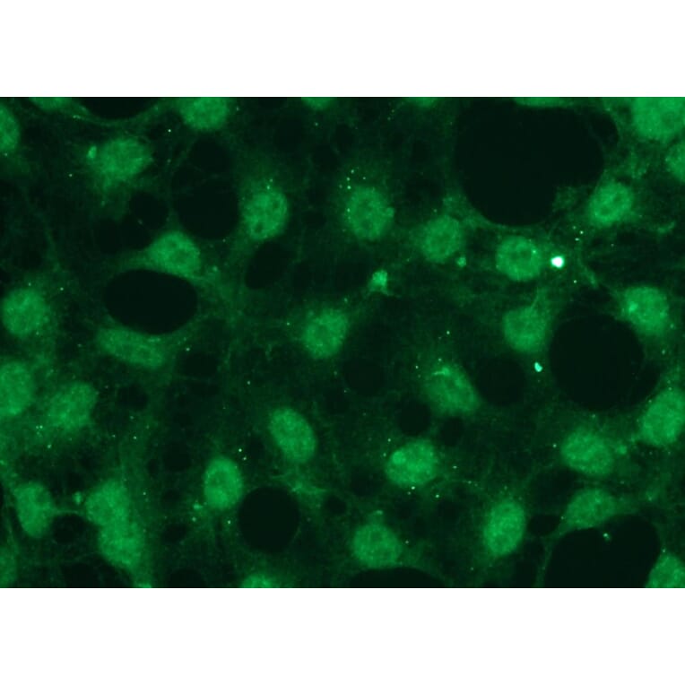 Immunocytochemistry - Anti-Akt1 Antibody - Antibodies.com (A8276)