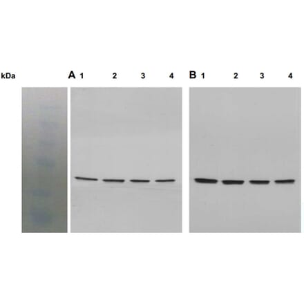 Western Blot - Anti-Akt1 (phospho Ser473) Antibody - Antibodies.com (A8277)