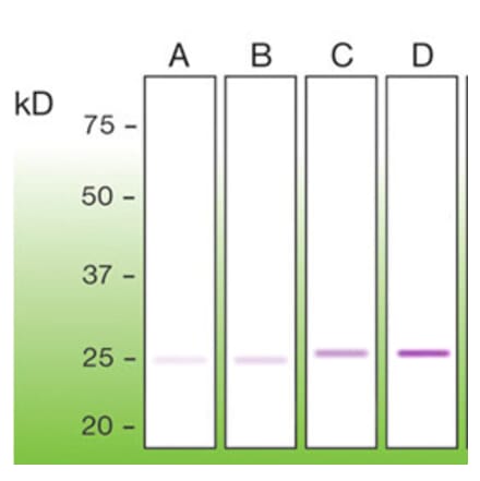 Western Blot - Anti-Bcl2 Antibody - Antibodies.com (A8278)