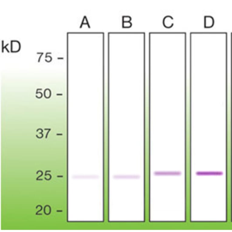 Western Blot - Anti-Bcl2 Antibody - Antibodies.com (A8278)