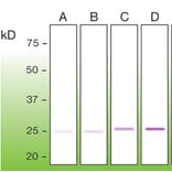 Western Blot - Anti-Bcl2 Antibody - Antibodies.com (A8278)