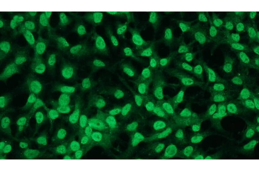 Immunocytochemistry - Anti-Bcl2 Antibody - Antibodies.com (A8278)