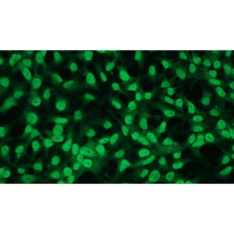 Immunocytochemistry - Anti-Bcl2 Antibody - Antibodies.com (A8278)