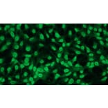 Immunocytochemistry - Anti-Bcl2 Antibody - Antibodies.com (A8278)