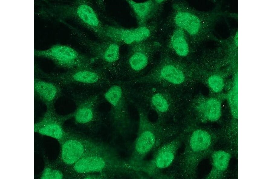 Immunocytochemistry - Anti-Bcl2 Antibody - Antibodies.com (A8278)