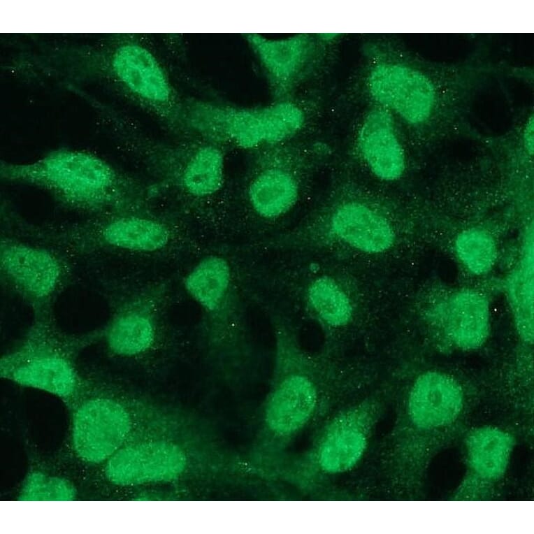 Immunocytochemistry - Anti-Bcl2 Antibody - Antibodies.com (A8278)