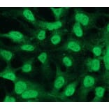 Immunocytochemistry - Anti-Bcl2 Antibody - Antibodies.com (A8278)