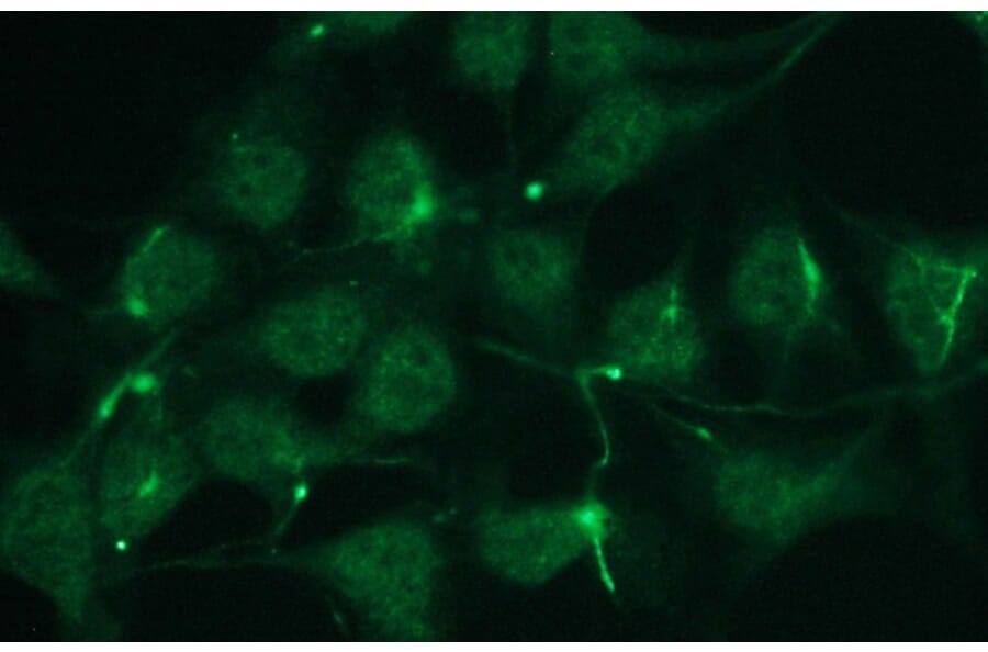 Immunocytochemistry - Anti-p63 Antibody - Antibodies.com (A8279)