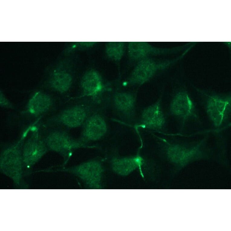 Immunocytochemistry - Anti-p63 Antibody - Antibodies.com (A8279)