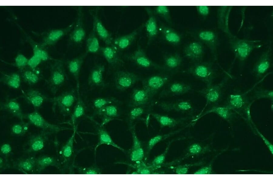 Immunocytochemistry - Anti-p38 alpha Antibody - Antibodies.com (A8280)