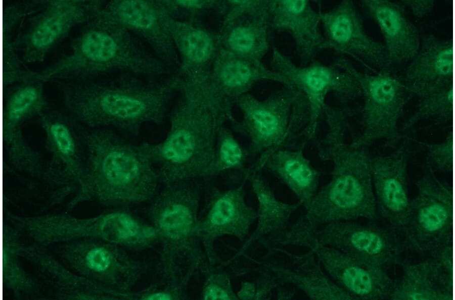 Immunocytochemistry - Anti-AKT3 Antibody - Antibodies.com (A8286)