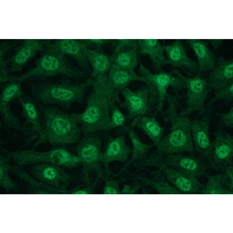 Immunocytochemistry - Anti-AKT3 Antibody - Antibodies.com (A8286)