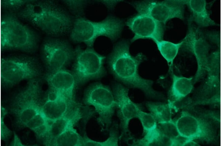 Immunocytochemistry - Anti-S-100 Antibody - Antibodies.com (A8289)