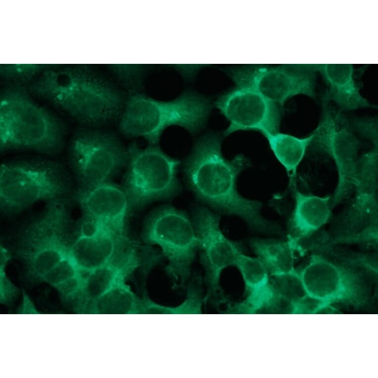 Immunocytochemistry - Anti-S-100 Antibody - Antibodies.com (A8289)