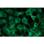 Immunocytochemistry - Anti-S-100 Antibody - Antibodies.com (A8289)