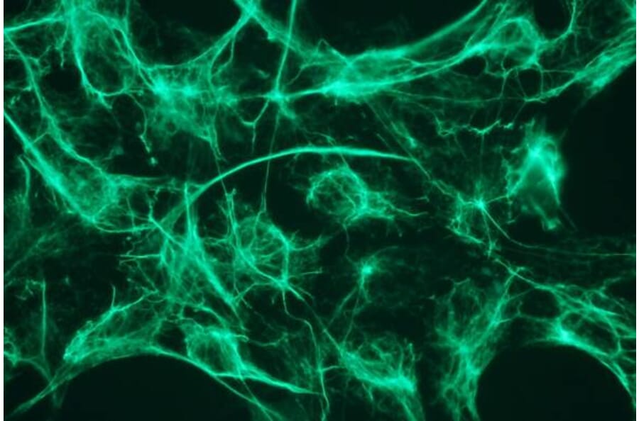 Immunocytochemistry - Anti-Cytokeratin 18 Antibody - Antibodies.com (A8290)