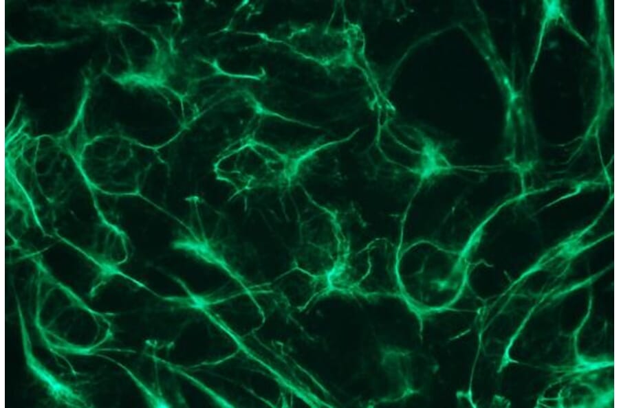 Immunocytochemistry - Anti-Cytokeratin 19 Antibody - Antibodies.com (A8291)