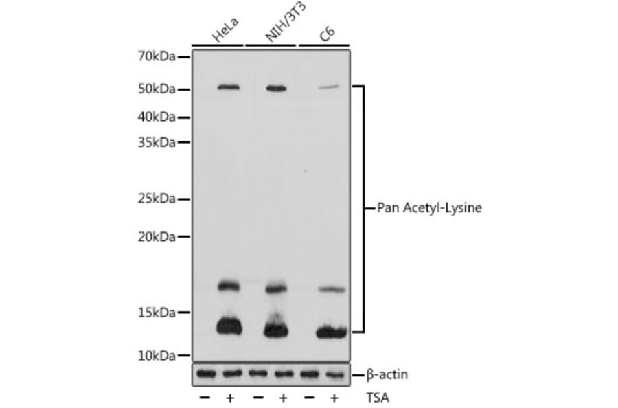 Western Blot - Anti-pan acetyl Lysine Antibody (A8327) - Antibodies.com