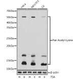 Western Blot - Anti-pan acetyl Lysine Antibody (A8327) - Antibodies.com