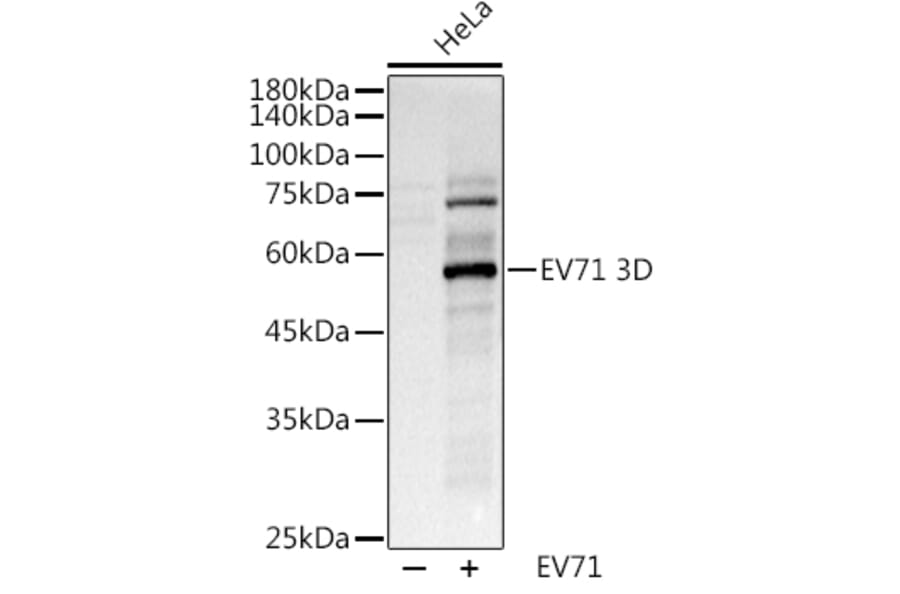 Western Blot - Anti-Enterovirus 71 3D Antibody (A8332) - Antibodies.com