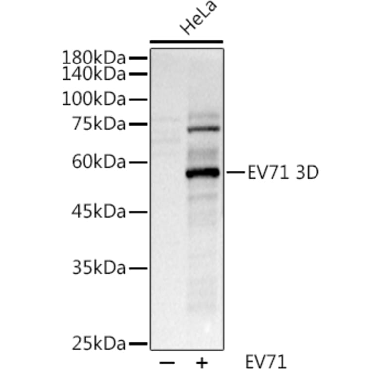 Western Blot - Anti-Enterovirus 71 3D Antibody (A8332) - Antibodies.com