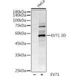 Western Blot - Anti-Enterovirus 71 3D Antibody (A8332) - Antibodies.com