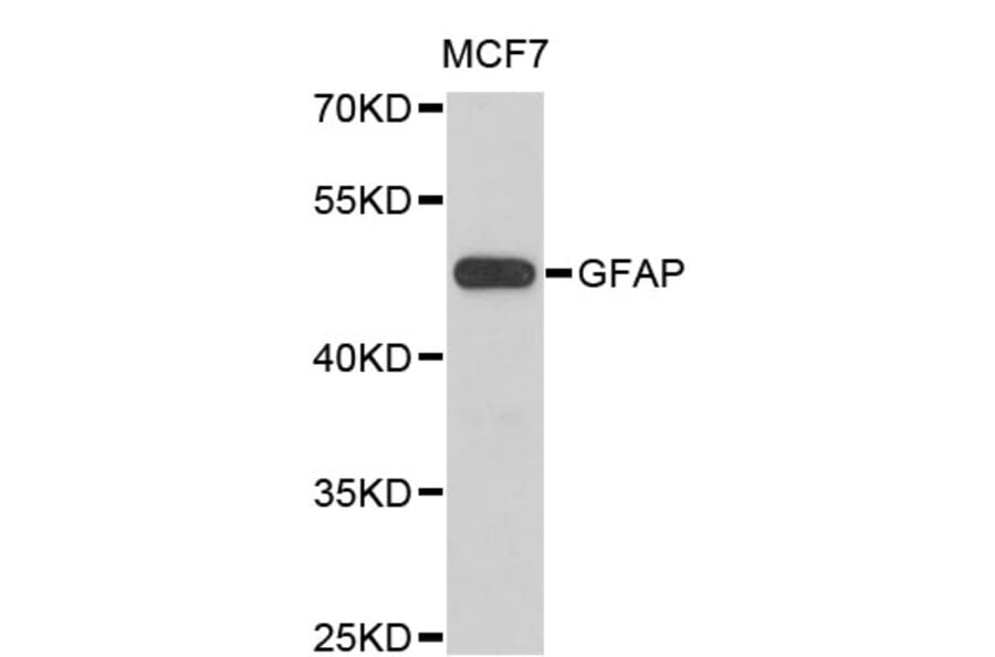Western Blot - Anti-GFAP Antibody (A0014) - Antibodies.com