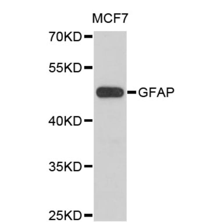 Western Blot - Anti-GFAP Antibody (A0014) - Antibodies.com