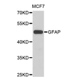 Western Blot - Anti-GFAP Antibody (A0014) - Antibodies.com
