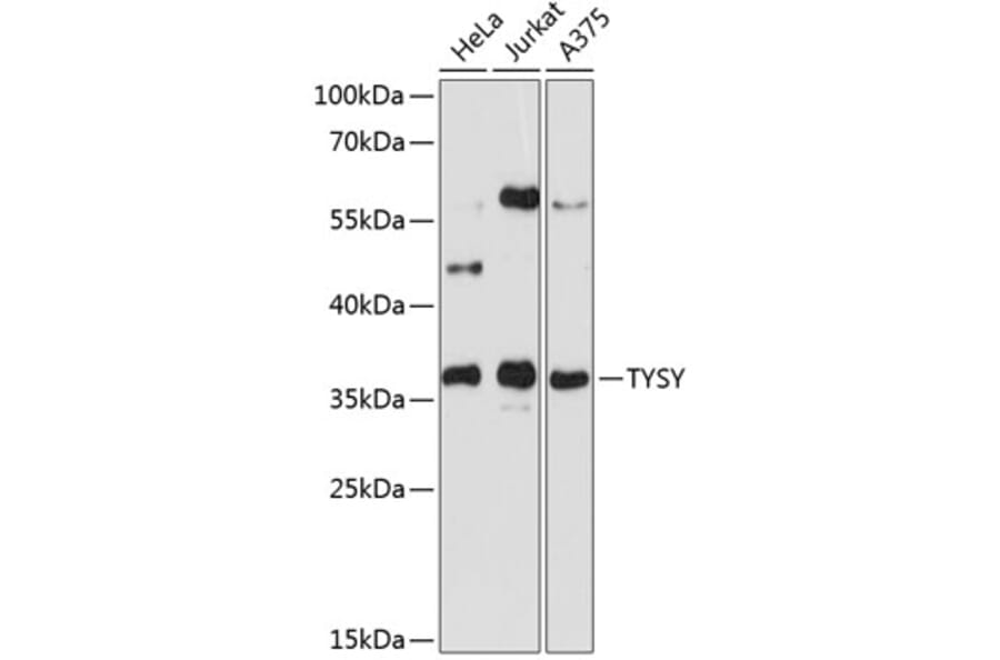 Western Blot - Anti-TYSY Antibody (A0017) - Antibodies.com
