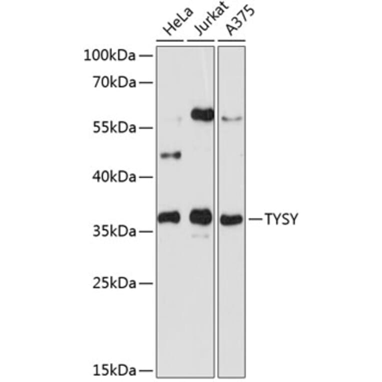 Western Blot - Anti-TYSY Antibody (A0017) - Antibodies.com