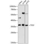 Western Blot - Anti-TYSY Antibody (A0017) - Antibodies.com