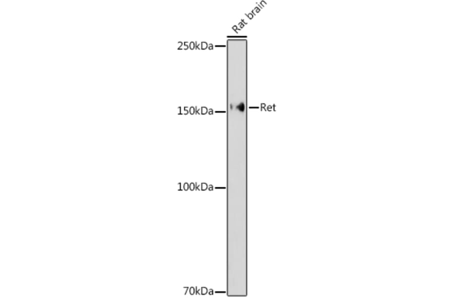 Western Blot - Anti-Ret Antibody (A8336) - Antibodies.com