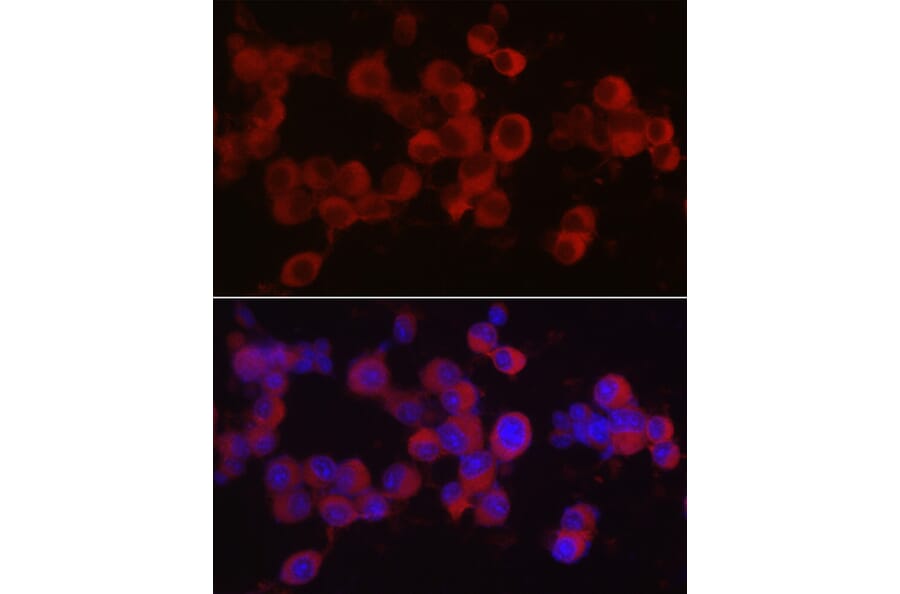 Immunofluorescence - Anti-Ret Antibody (A8336) - Antibodies.com