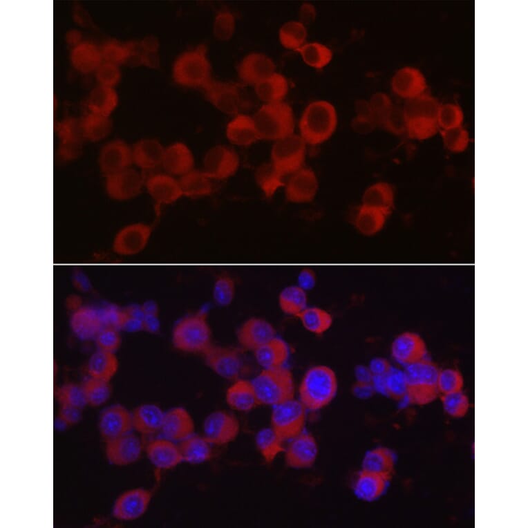 Immunofluorescence - Anti-Ret Antibody (A8336) - Antibodies.com