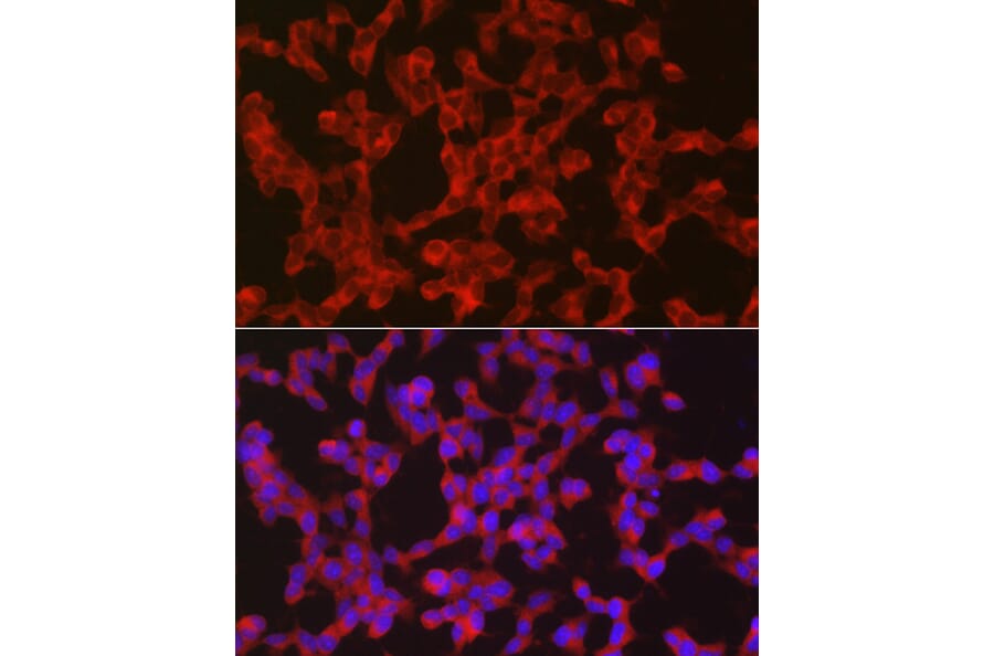 Immunofluorescence - Anti-Ret Antibody (A8336) - Antibodies.com