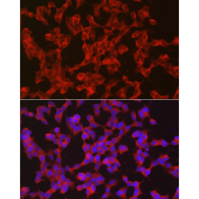 Immunofluorescence - Anti-Ret Antibody (A8336) - Antibodies.com