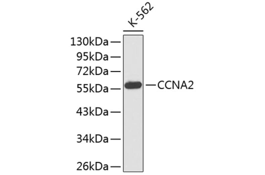 Western Blot - Anti-CCNA2 Antibody (A0034) - Antibodies.com